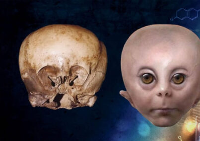 Starchild bambino con il teschio a forma di alieno Copertina
